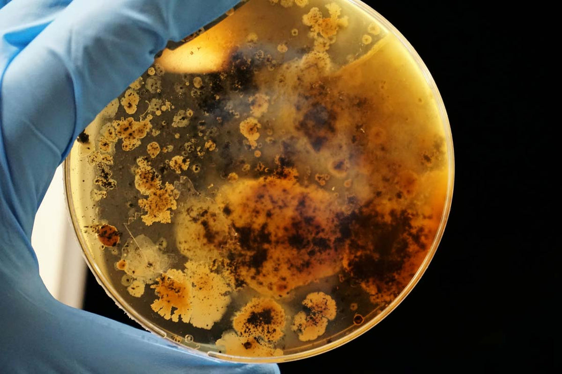 Hand in blue latex glove holds up petri dish with bacterial cultures growing inside
