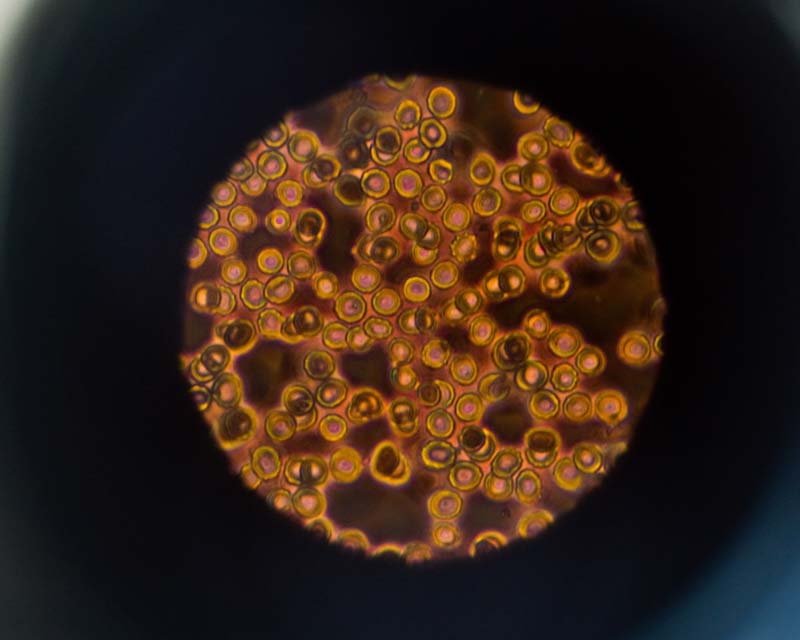 Red blood cells seen through a microscope