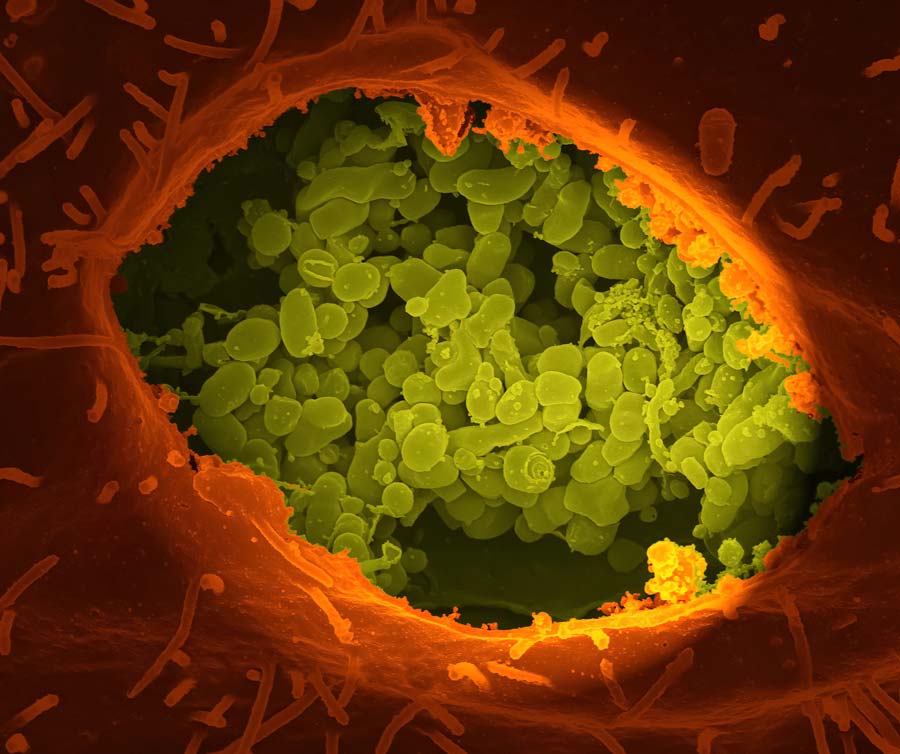 Digitally-colored scanning electron microscope image of Coxiella burnetii bacteria