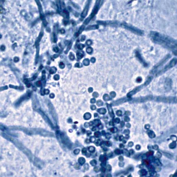 Malassezia cells under microscope